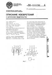 Способ гетеро-трансплантации почки (патент 1111742)