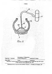 Способ извлечения металлической арматуры из покрышки (патент 1799325)