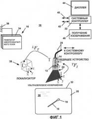 Система и способ автоматической калибровки отслеживаемого ультразвука (патент 2478980)