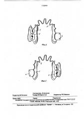 Профилактический детский зубной протез нижней челюсти (патент 1736464)