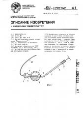 Устройство для рассечения сужений трубчатых органов (патент 1292752)