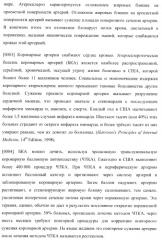 Захват эндотелиальных клеток-предшественников элюирующим лекарственные средства имплантируемым медицинским устройством (патент 2400256)