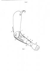 Протез плеча (патент 733677)