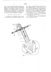 Устройство для закрытия якорного клюза (патент 471238)
