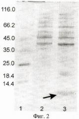 Рекомбинантная плазмидная днк pет22b(+)/slurp-1, кодирующая белок slurp-1, и штамм бактерий escherichia coli bl21(de3)/pet22b(+)/slurp-1-продуцент белка slurp-1 человека (патент 2453602)