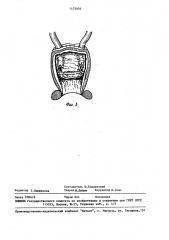 Способ формирования искусственного мочевого пузыря (патент 1475604)