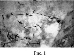 Способ диагностики туберкулеза (патент 2525428)