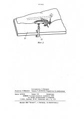 Устройство для проведения спицы в шейку бедра (патент 1161102)