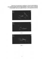 Способ трансректального ультразвукового сканирования при проведении трансуретральной лазерной энуклеации предстательной железы (патент 2610916)