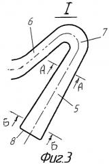 Хирургический инструмент для эндартерэктомии (патент 2407466)