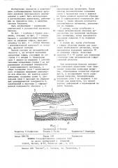 Баллон давления (патент 1214976)