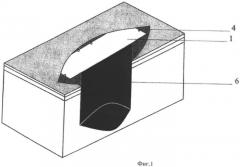 Превентивная пластика передней брюшной стенки при инфицированной абдоминальной ране (патент 2480169)