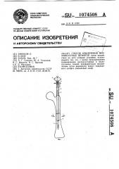 Способ извлечения внутрикостных штифтов (патент 1074508)