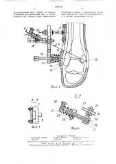 Устройство для лечения переломов лодыжек (патент 1627159)
