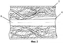 Имплантат для замещения костных фрагментов (патент 2357702)