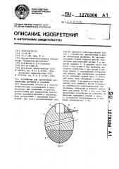 Устройство для закрепления акустических датчиков в скважине (патент 1270306)