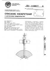 Способ репозиции отломков (патент 1156677)