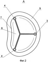 Протез митрального клапана сердца (патент 2541740)
