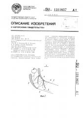 Улавливатель плодов (патент 1311657)