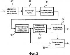 Мониторинг мерцательной аритмии (патент 2496413)