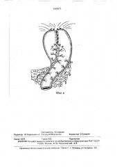 Способ проксимальной резекции желудка (патент 1666077)