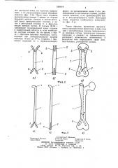 Внутрикостный фиксатор (патент 1082416)