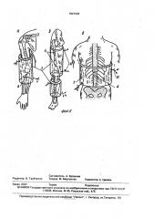 Индивидуальная повязка крошневой а.а. (патент 1827232)