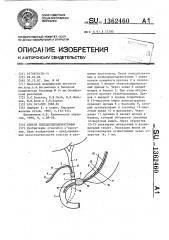 Способ холедоходуоденостомии (патент 1362460)