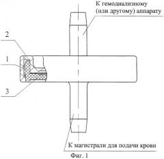 Разделительный фильтр для системы магистралей подачи крови (патент 2248811)