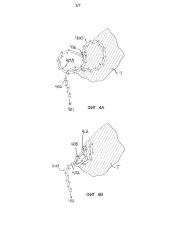 Самоудерживающиеся нити с регулируемой петлей (патент 2659454)