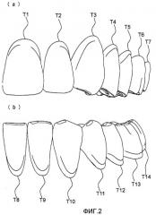 Искусственные зубы, позволяющие легко достигнуть двухсторонней сбалансированной окклюзии (патент 2456956)