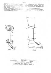 Устройство для фиксации стопы (патент 902746)