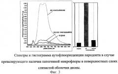 Способ аутофлюоресцентной диагностики заболеваний тканей пародонта (патент 2286573)