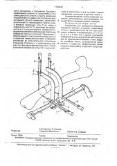 Устройство для измерения величины смещения костных отломков (патент 1764638)