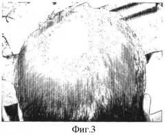 Композиция по уходу за кожей головы и волосами (патент 2404736)
