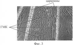 Способ получения культуры гладкомышечных клеток (патент 2529947)