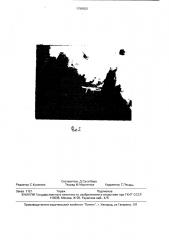 Способ лечения переломов нижней челюсти (патент 1799550)