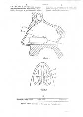 Фиксатор носовой перегородки (патент 492278)