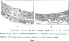Способ коррекции структурных перестроек сосудов в эксперименте (патент 2349320)