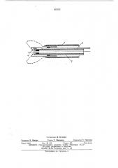 Экстрактор камней мочеточника (патент 457471)