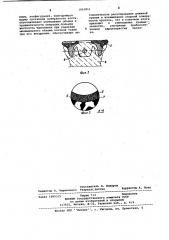 Эндопротез коленного сустава (патент 1061811)