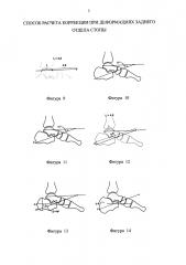 Способ расчета коррекции при деформациях заднего отдела стопы (патент 2634043)