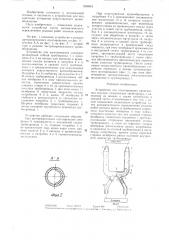 Устройство для шунтирования кровеносных сосудов (патент 1304818)