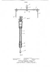 Устройство для лечения переломов костей нижней конечности (патент 1250282)