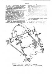 Аппарат для лечения переломов верхней челюсти (патент 596230)