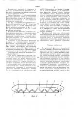 Внутрикостный фиксатор (патент 1426557)