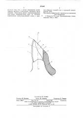 Зубная коронка (патент 572264)