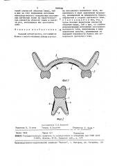 Съемный зубной протез (патент 1602506)