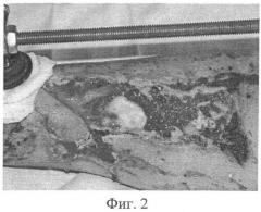 Способ замещения посттравматического дефекта большеберцовой кости, сопровождающегося обширной раневой поверхностью (патент 2487684)
