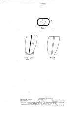 Зубная коронка (патент 1358951)